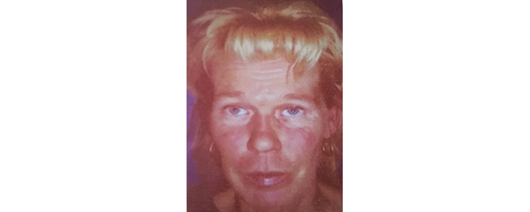 L'invecchiamento Cutaneo: Tipologie e Rimedi