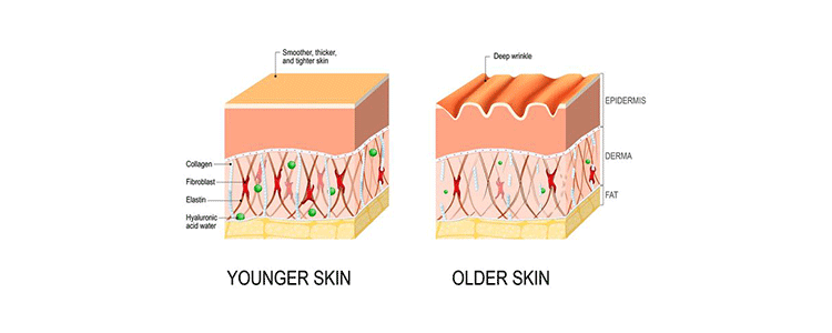 L'invecchiamento Cutaneo: Tipologie e Rimedi